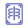 Digital X-ray
